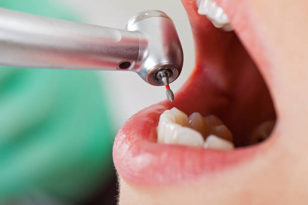 Best Emergency Cosmetic Dentistry in Santa Rosa, TX